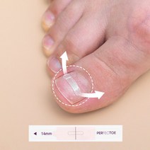[특허청 실용신안 등록] 퍼펙토 내성발톱 교정기 자가치료 세트, 16mm 스트립