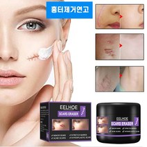 흉터제거연고 수술흉터제거 연고 화상상처 재생크림 여드름흉터 치료, 1개, 50ml