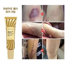 JOYPRETTY 흉터제거연고 수술 화상 상처 흉터 겔, 40g, 1개