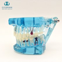 덴티폼 임플란트 치과 입모형 모형 재료상 치아, 블루리페어2001-