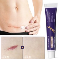 [당일배송] DRYMATINE 흉터연고 흉터제거연고 재생크림 상처흉터연고 여드름흉터 수술흉터 화상물집 흉터제거연고 20g, 1개, 20ml