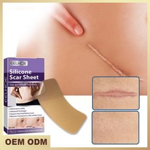 롤 실리콘 흉터 시트 무통 수리 테이프 효과적인 제거 스트립 C 섹션 켈로이드 수술 화상 여드름 C9P3
