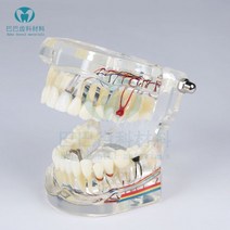 치아 모형 치과 모양 재료상 입모형 덴티폼 임플란트 치과기공사 치과위생사, 베이직 + 신경