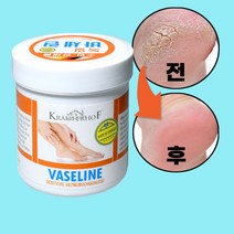 발바닥껍질벗겨짐 크림 2개 발각질제거 연화제 발각화증 크림 코 블랙헤드 제거 올리브영 크림 발뒤꿈치 각질연화제