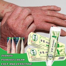 건선크림 아토피 피부습진 완화 크림 가려움방지 크림 보습제, 상자가있는 10pcs