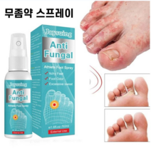 무좀 치료 발가려움 스프레이 에센스 항감염 무좀치료제 풋 케어 세럼, 50ml, 2개, 1개