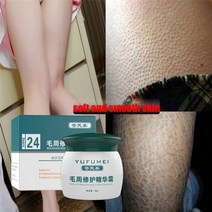 50g 경화 케라 토시스 필라/Kp/치킨 스킨 바디 로션 스킨 리페어 크림 스킨 케어 에센스 모이스춰 라이징 및 영양