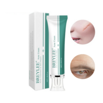 Acne Scar Removal Cream, 1.06 ounces