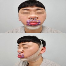 [풀패키지] 업앤드배러 입벌림 코골이 이갈이 방지 밴드 테이프 비강확장기 FULL SET, 리뷰 약속X(FULL SET)