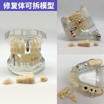 치아모형 인체모형도 치과기구 실리콘몰드 인체모형 양치교구 재료상, 부분 탈착 가능한 수복 치아