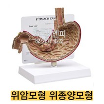 미국/위암모형 위종양모형 G2001/위 단면 위치별 명칭 카드 포함