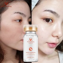 미소온열 갈바닉 얼굴 쿨링 스팀 고주파 히알루론산 에센스 페이셜 스킨 모이스춰 라이징 미백 안티 에이징, 한개옵션0