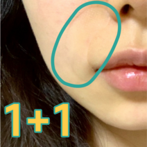 1+1 팔자주름 미간주름 눈가주름 패치, 삼각 타입(총24개입)