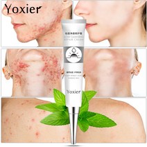 얼굴각질제거 피부스케일링 셀프케어 피부환생크림 바늘크림, 20g x 3개