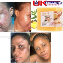 코코넛오일 마사지오일 가슴오일 바디오일생강 Tumeric 비누 여드름 다크 스팟 제거 스킨 화이트닝 바디 표, 한개옵션0