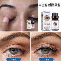 속눈썹 성장 세럼 흔적없이 가늘고 길어지는 속눈썹 세럼 속눈썹 영양제 10ml*2/4/6, (가늘고 길어지는 속눈썹 세럼 10ml)x2