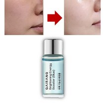 나비존요철 뽀로지 피지갈이액 여드름균 제거 앰플 블랙헤드 없애는법 눈밑주름 제거 불독살