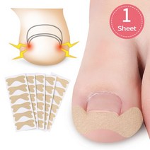 아빠 엄마 내성발톱 교정 자가치료 세트 내성 발톱 치료 교정 도구 20-4 개 패치 스티커 클립 브레이스 페, 06 6Pcs G179