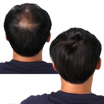 국내생산 감쪽이 정수리 가발 고열사 부분 3초 남자 여자 가발 부분가발, 감쪽이(자연갈색)