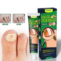 발톱무좀치료 발톱무좀약 발톱무좀 습진 가려움 발냄새 발각질 완화, 30g, 5개