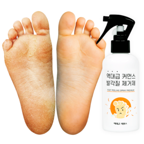 역대급커먼스 발각질 제거제 풋 필링 스프레이, 1개입, 1개, 200ml