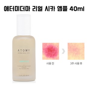 애터미 더마 리얼 시카 앰플, 40ml, 1개