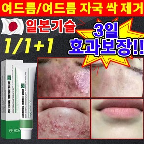 일본 1/1+1 여드름 제거 연고 색소침착 흉터 치료 리페 어 여드름 스팟 방지 문제 피부 케어 미백 재생 크림, 2개, 20g