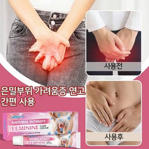 [미국 수입]사타구니가려움연고습진사타구니통증사타구니가려움사타구니습진고환가려움엉덩이습진LK007, 2개, 20g