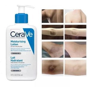 바디 CeaVe 페이스 워시 여드름 트리트먼트 2% 살리실산 클렌저 클레이 지성 피부 블랙헤드 리무버 막힌 모공 컨트롤, 236ml, 1개