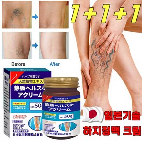 [일본 기술] 하지정맥 크림 하지정맥류 다리부종 정맥염 혈관염 치료 크림