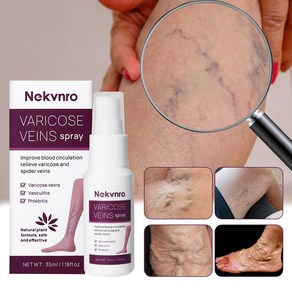 Nekvno 하지정맥 스프레이 정맥 정맥류 케어 다리마사지 붓기빼는약, 1개, 35ml