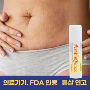 안틀레이 튼살 전용 점착성 투명 필름 창상피복재 스틱 연고, 2개, 15ml