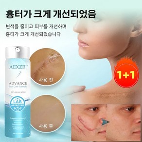 1+1 흉터 제거 스프레이 흉터제거연고 흔적 개선 흉터 제거, 2개, 20ml