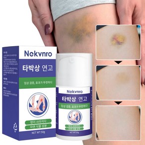 Nekvno 멍크림 흔적 진정 케어 스포츠 마사지 크림 근육 부기 및 통증 완화 케어한방 허브 에센스 멀티 마사지 크림 머슬 크림 붓기완화, 2개, 50g