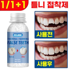 [국내배송] 임시 틀니 의치 임시치아 접착제 셀프 임시틀니 만들기 치과 재료 포장증정, 1개