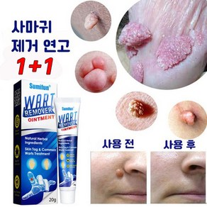 [국내배송/효과보증] 1/1+1 각종 피부 고민 해결 크림, 20g, 2개