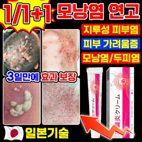 [당일출고] 일본 모낭염 연고 피부가려움증 지루성피부염 연고 여드름 크림 포장증정