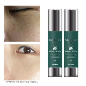 기미 잡티 주근깨 미백 진정 색소침착 착색 수분 보습 재생 센텔라 시카 세럼, 2개, 50ml