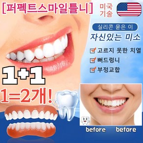 1/1+1[국내배송] 실리콘 틀니 세트 가짜 이빨 임시치아, 4개