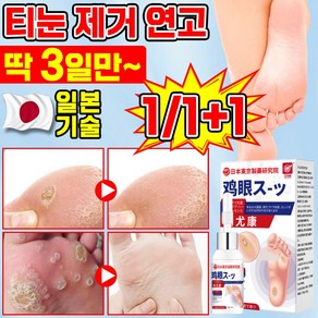 [빠른 배송] 1/1+1 일본 기술 연고 발바닥 굳은살 제거 연고 육가시 통증 제거 풋케어 크림, 4개, 15ml