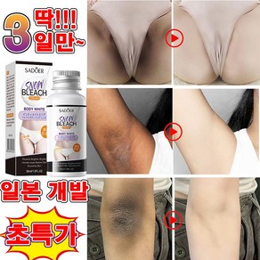 [일본 개발] 색소침착 미백 크림 겨드랑이 착색크림 멜라토닝 크림 사타구니 팔꿈치 엉덩이 비디미백 멜라닌 크림