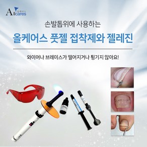 올케어스풋젤 하드 소프트 내성발톱 파고드는 발톱교정 젤레진 고정 Allcaes footgel, 풋젤소프트, 1개