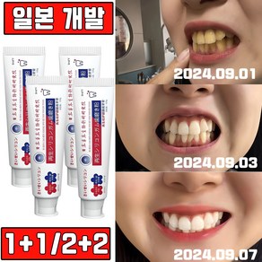 [치과추천] 일본 2+2/3+3 고불소 미백 치약 화이트닝 누렁니 구취제거 염증 예방 안심배송 증정, 2개, 120g
