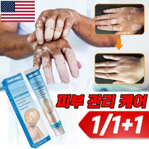 미국기술 1+1 백반증 치료 연고 손 목 얼굴 착색 피부치료 연고, 3개, 20g