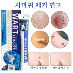 [국내배송]사마귀 피부 치료/강력한 사마귀 제거/일주일의 이별/편평사마귀/얼굴 사마귀/닭의 눈/좁쌀알/증세W033, 2개, 20g