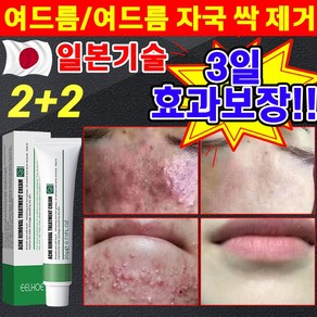 일본 1/1+1 여드름 제거 연고 색소침착 흉터 치료 리페 어 여드름 스팟 방지 문제 피부 케어 미백 재생 크림, 4개, 20g