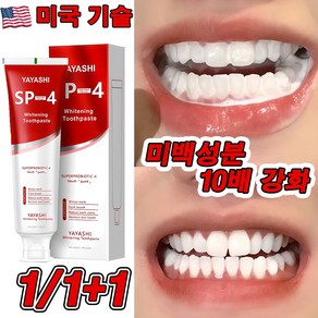 미국 SP4 1+1/2+2 고불소 미백 치약 프로바이오틱 치약 화이트닝 잇몸붓기 염증 예방 구취케어 치약