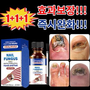 [당일배송] 솔루션 문제성 발톱 손톱 발각질 발각질연화제