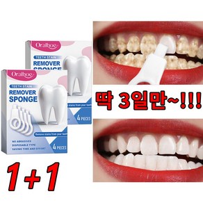 치아 노폐물 제거 치아미백 치아청결 치아 미백, 4개, 4ml