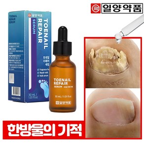 일양약품 문제성 손발톱 전문 리페어 세럼 영양제 토네일